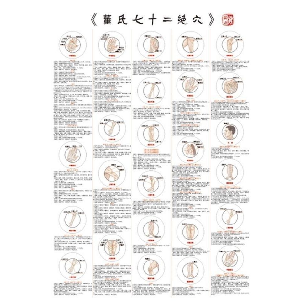 董氏奇穴七十二绝穴针灸穴位挂图高清图董氏奇穴针灸70*100CM加大