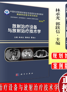 放射治疗设备技术丰富实际案例