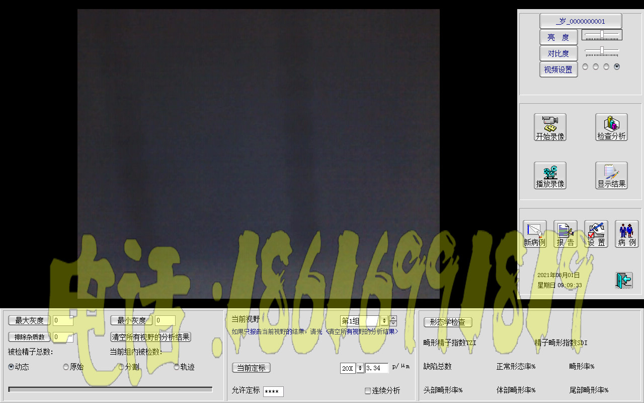 精液分析WHO5精子分析随心所欲软件精液分析XP/Win7/win10加密锁