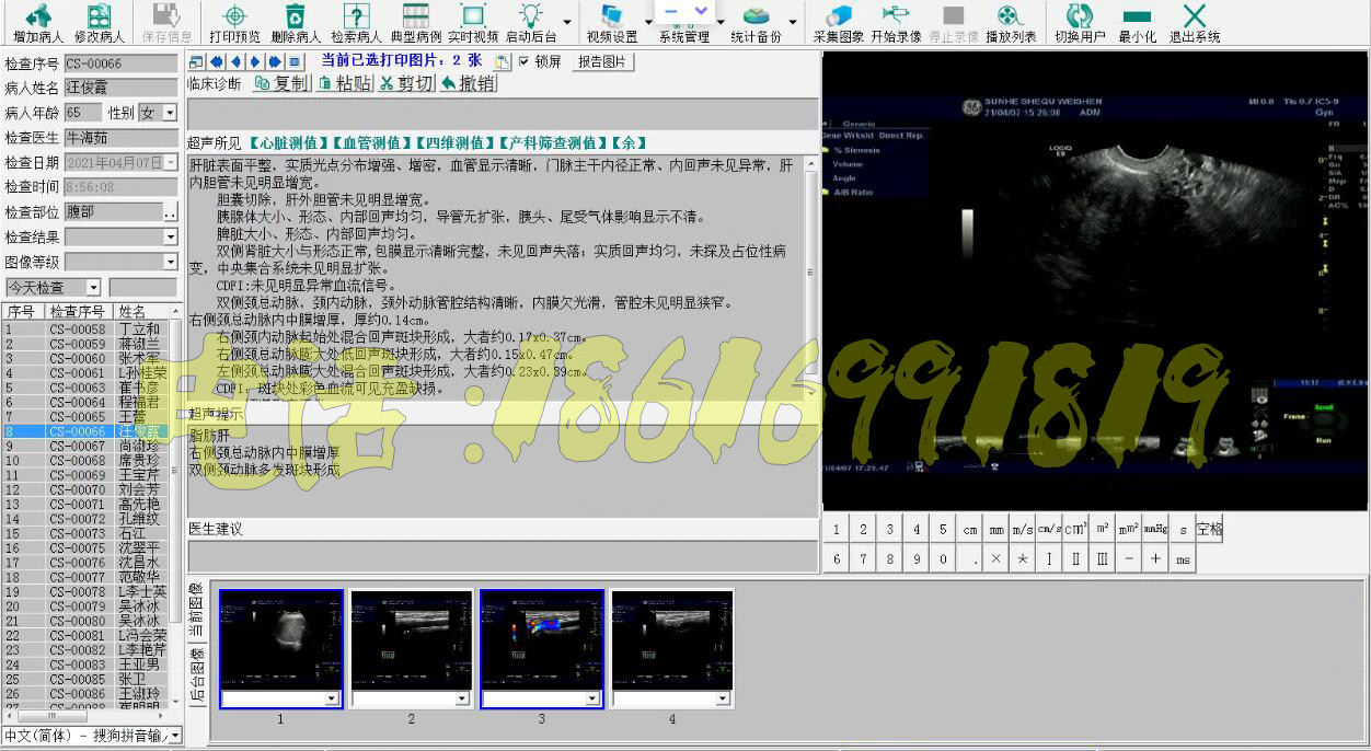 B超软件彩超软件超声工作站软件+采集卡+脚踏板+连接线全套包邮