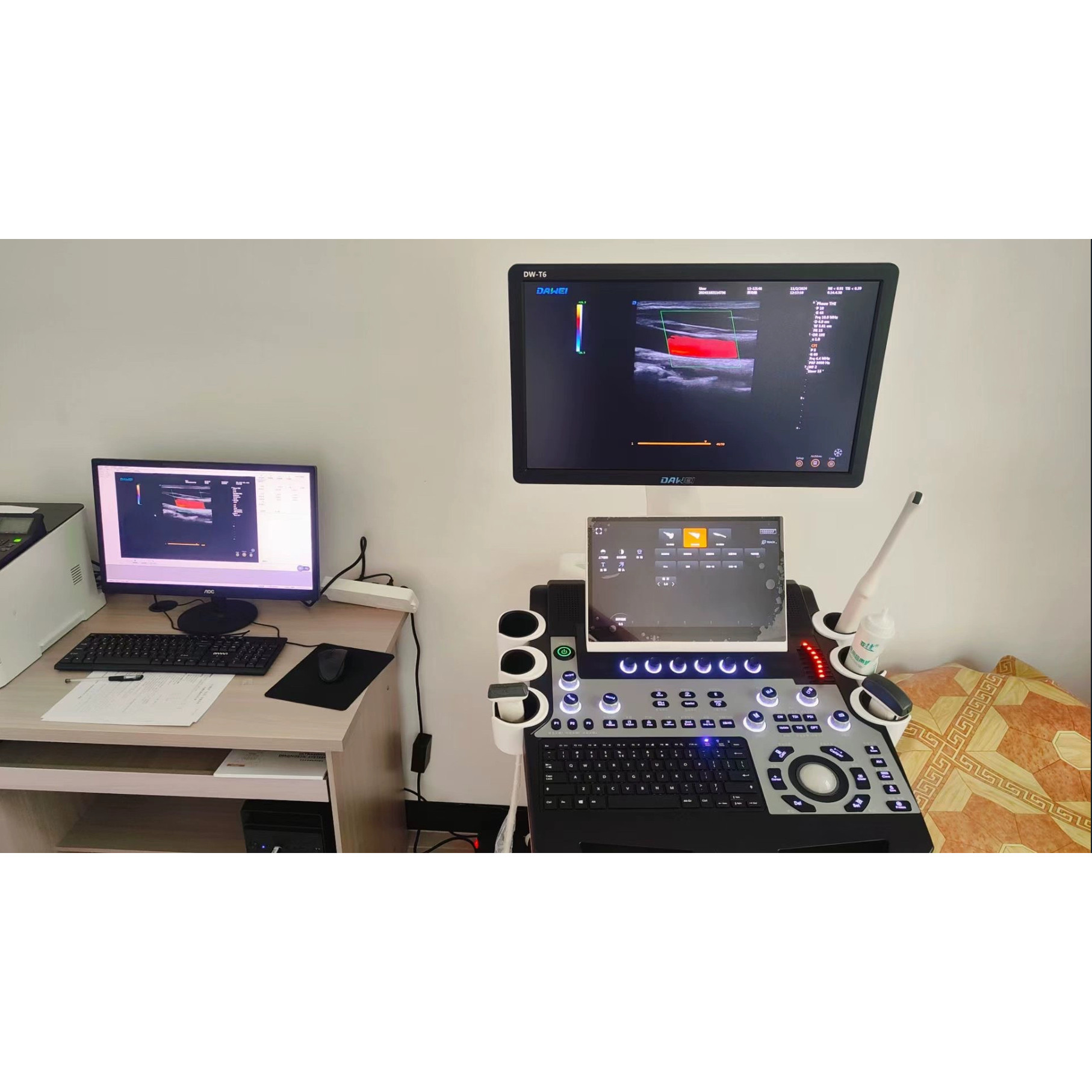 高清彩超工作站B超软件超声图文报告软件超声影像WIN11版加密狗