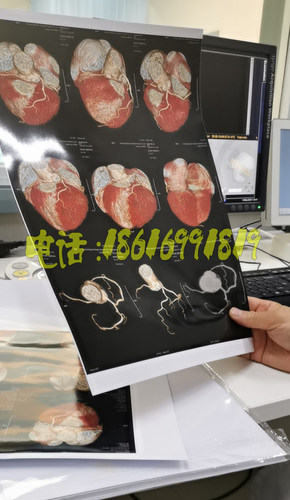 Dicom打印软件胶片打印转换喷墨胶片打印软件CR\DR\CT喷墨打印