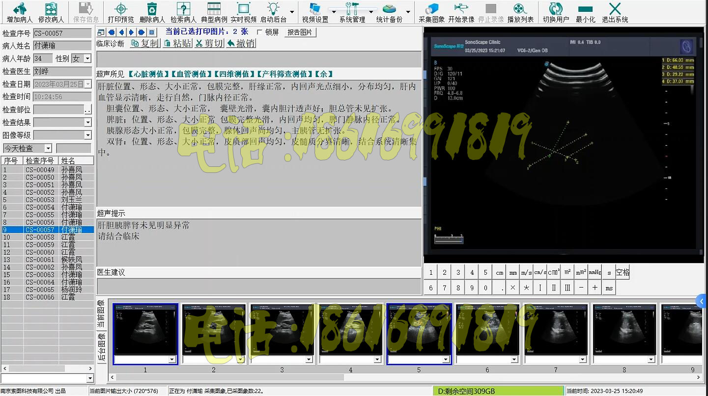 新版超声软件B超软件B超工作站软件彩超软件B超软件win10/win11