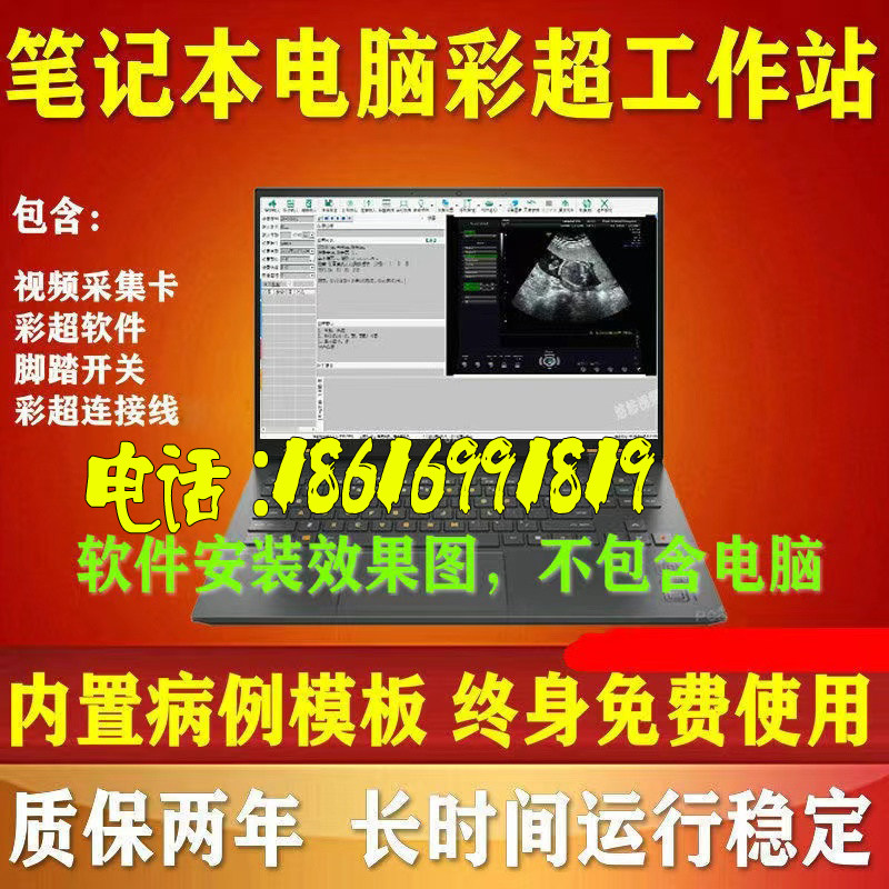 笔记本彩超工作站超声影像软件+采集卡+脚踏板+连接线全套包邮