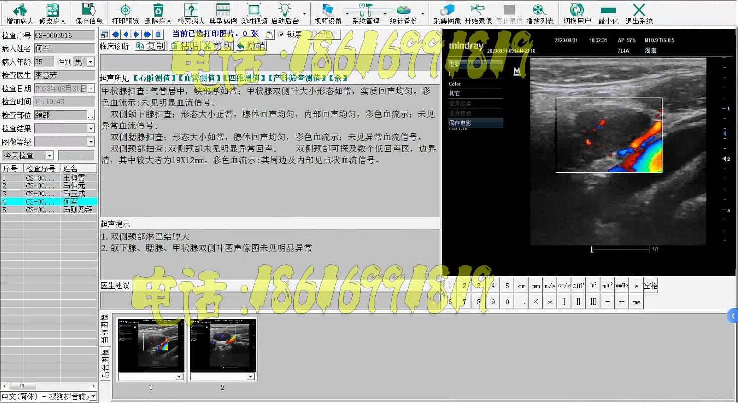 彩超工作站B超软件超声工作站软件超声影像Win10版超声软件加密狗
