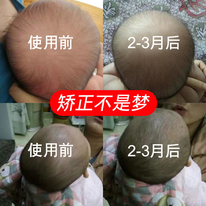 婴儿枕头夏季透气0-1岁定型枕新生纠正偏头宝宝头型矫正儿童枕头