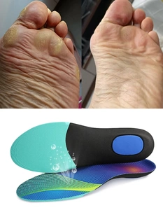 拇外翻矫正鞋垫横弓塌陷改善鞋垫足弓垫足外翻拇指外翻足弓支撑