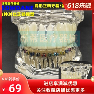 牙科牙模型隐形正畸模型医患沟通讲解教学模型正畸2种对比模型