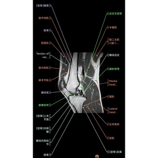 影像解剖图谱app，中文版eanatomy 终身卡，安卓 鸿蒙 电脑可以用