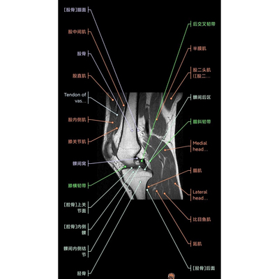 影像解剖图谱app，中文版eanatomy 终身卡，安卓 鸿蒙 电脑可以用