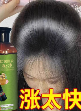 【官方正品】固发洗发水固发液防脱增发密发固发发际线增长