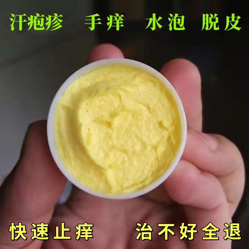 手上起小水泡止痒中药抑菌鹅掌风汗泡疱真菌感染手气湿痒疹专用膏图片