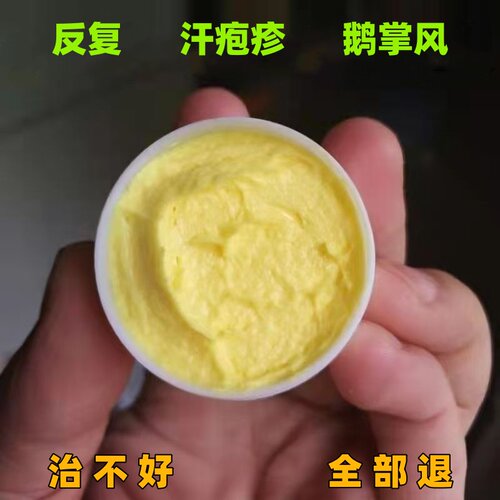 手上起小水泡止痒中药抑菌鹅掌风汗泡疱真菌感染手气湿痒疹专用膏