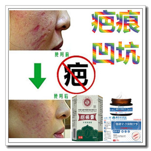 消除烟疤去手术产后凹凸增生性疙瘩淡化开刀伤疤痕印碰伤撞伤药膏