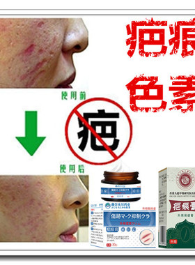 草本祛黑色素沉着回流色素印痕霜淡化抓痕黑印红印产品正品药膏贴