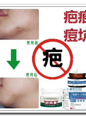 祛修复增生性凸疤手术药膏伤疤痕印黑印抓痕淡化黑色素沉着回流液