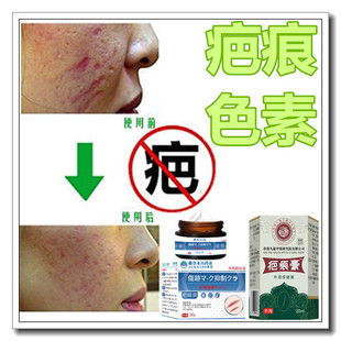 正品消除烧伤手术巴疙瘩软化增生祛烟烫黑色素去凹凸烟疤痕印药膏