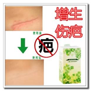 消祛手术摔伤疤痕伤口贴愈合凝胶去除耳洞凸起硬疙瘩陈旧修复药膏