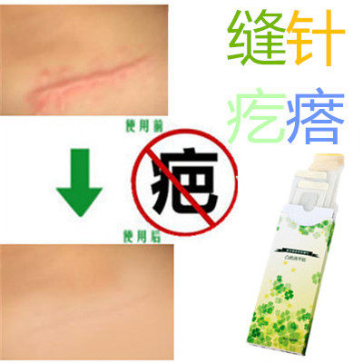 消除增生性突起缝针伤疤痕印灵淡化烟烫色素沉淀祛手术后色素疙瘩