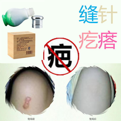 淡疤护理