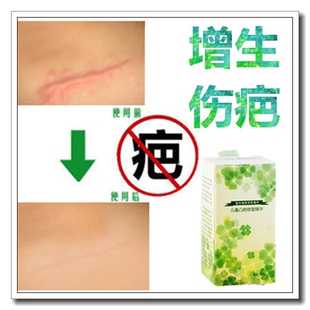 去除伤口贴修复儿童药膏消祛手术摔伤疤痕灵愈合凝胶软化增生疙瘩