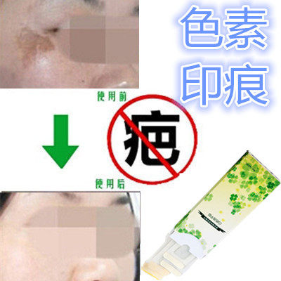 精华液去除男女脸上增生疤痕疙瘩复方精油