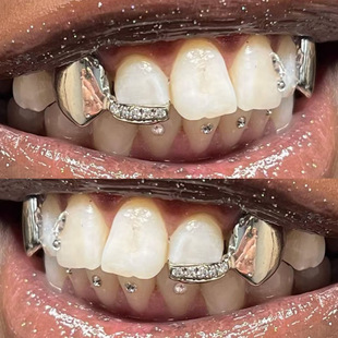 欧美热卖新款对称尖牙锆石牙套横杠组合个性假牙男士跨境嘻哈配饰