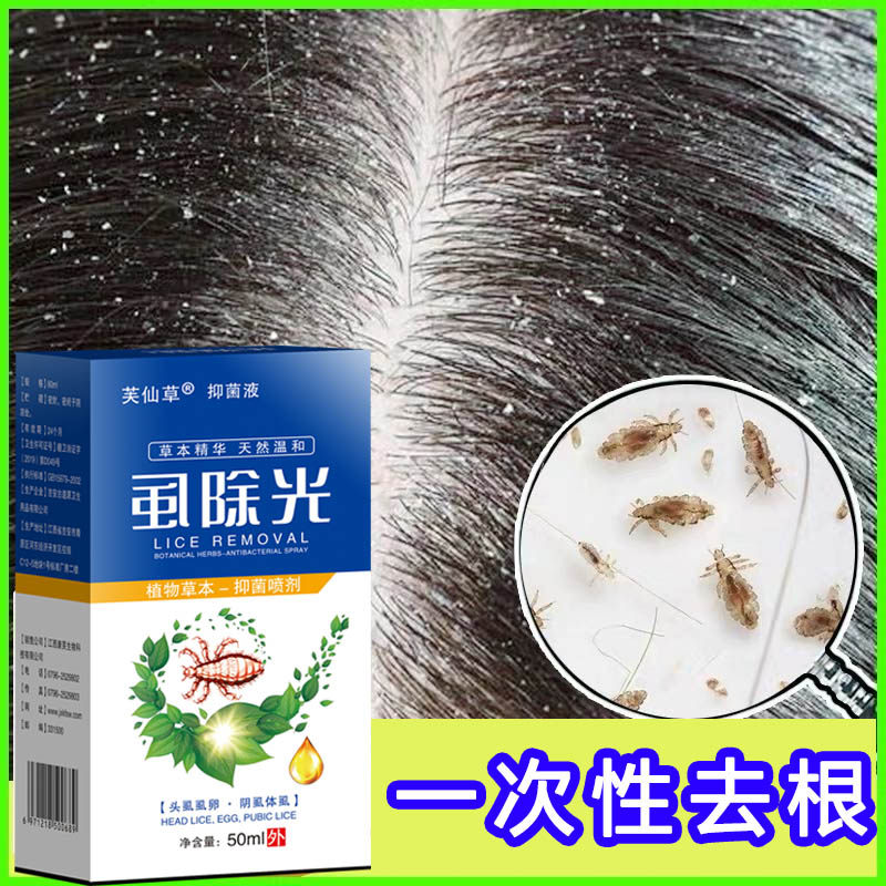 去虱子除杀头上长虱子卵的洗发水神器虱子药儿童头发头虱子小女孩