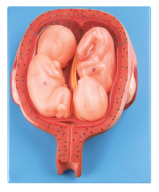 五个月双胞胎模型/怀孕五月双胞胎模型带指标标志/gd/a42005/8