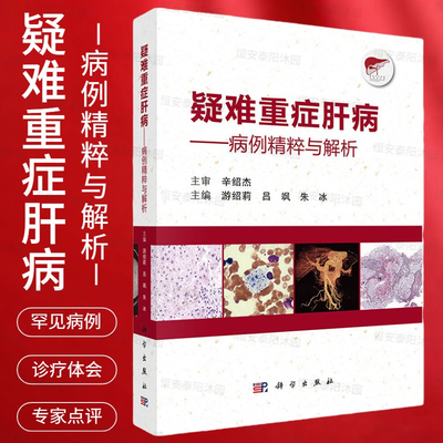 疑难重症肝病病例精粹与解析游绍莉吕飒朱冰编疑难罕见肝病病例诊治医师诊疗体会专家点评病例分析科学出版社