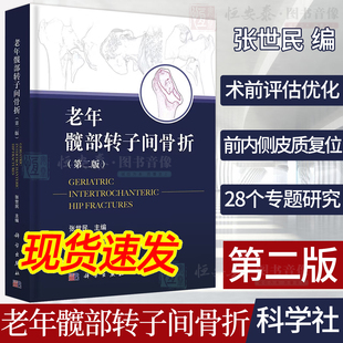 老年髋部转子间骨折第二版 现货 张世民老年骨折骨伤科学骨质疏松麻醉选择疼痛管理前内侧皮质支撑复位外科学科学社 2023新版