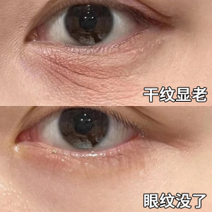 【屈臣氏同款爆卖】再见眼角纹 淡化黑眼圈 类肉毒肽丰眼精华素~