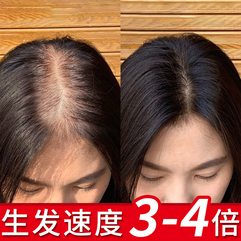【同济堂-生姜洗发水】头发自然生长速度 变密变多变长 买2送1