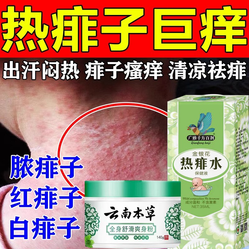 成人痱子水祛痱止痒专用热痱水去痱子喷雾大人痱子粉爽身露热菲子