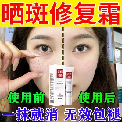 晒斑去除修复乳霜祛黄褐斑老年斑淡化黑色素雀斑脸上美专用药膏白