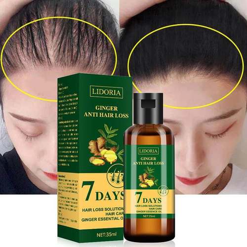 7DAYS Hair Growth Essential Oils Ginger Hair Loss Treatment