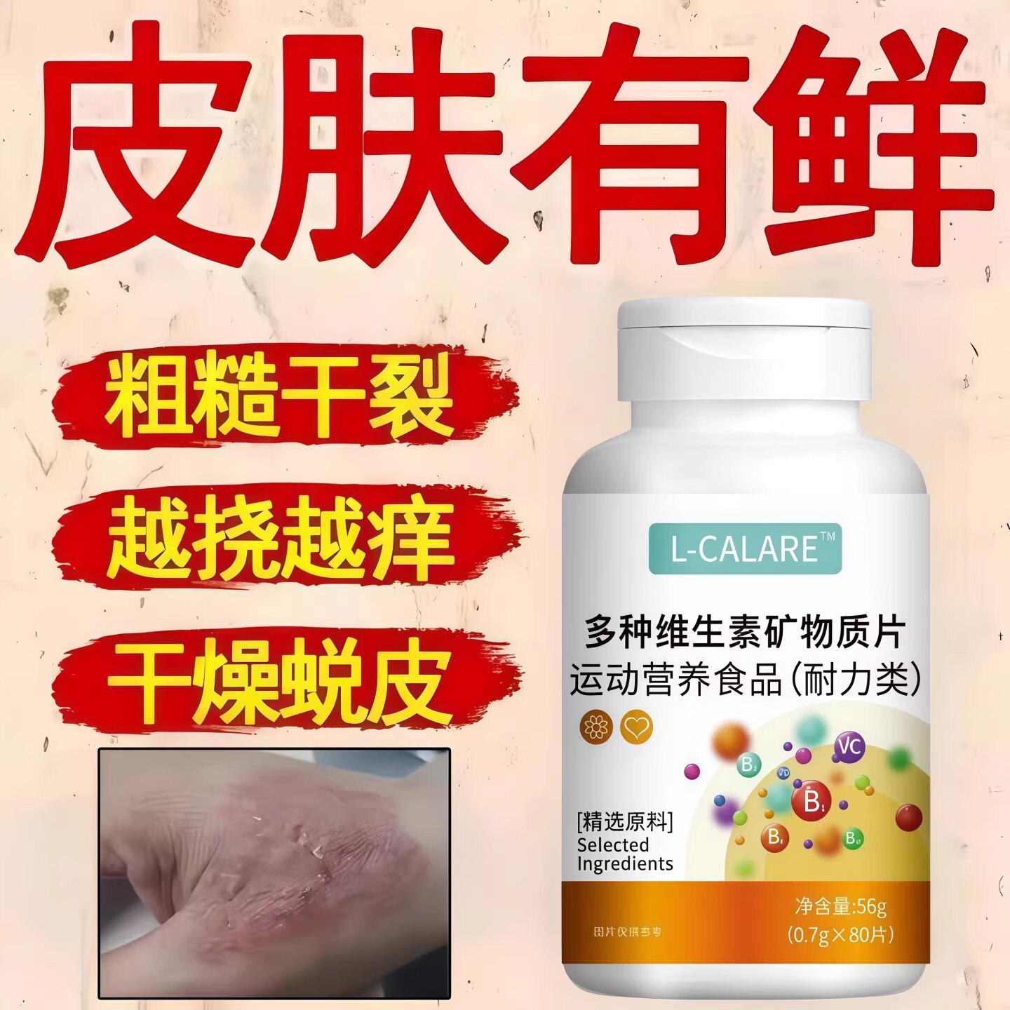 中夫子安肤素官方正品银肖白斑