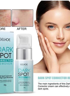Face Cream Freckles Remove Anti Age Black Spots Whitening