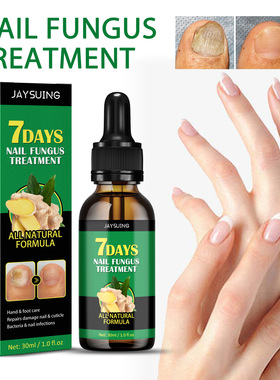 Ginger Nail Fungal Treatment Feet Essence Anti Infection