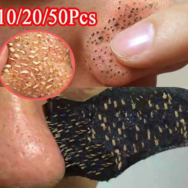 Blackhead Remover Nose Sticker Acne Treatment Mask Nose Sti图片