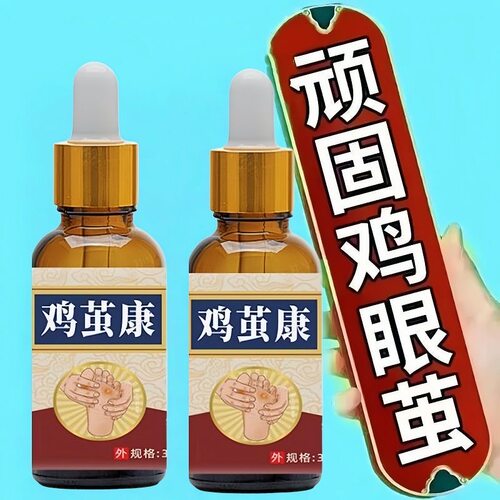 【鸡茧康】去除脚底老茧手足厚茧硬皮鸡眼膏脚趾关节茧脚垫软化剂
