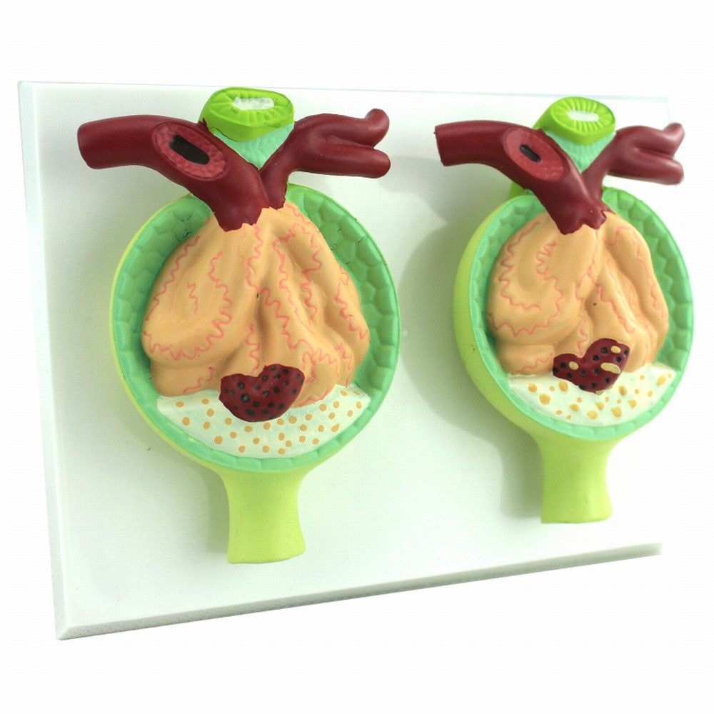 enovo颐诺医学蛋白尿模型人体肾脏模型肾小体解剖泌尿内科高血压糖尿