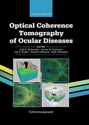 预售【外图英文原版】Optical Coherence Tomography of Ocular Diseases 眼部疾病的光学相干断层扫描