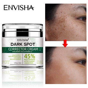 Face Skin Care Whitening Freckle Cream Remove Melasma Dark S