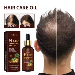 Rosemary Hair Oil Nourishing and Thickening Hair Hair Anti H