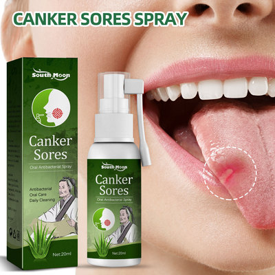 Mouth ulcer spray Swollen gums and painful mouth ulcers Fres