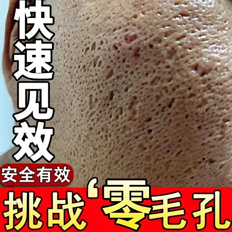 毛孔粗大修复收缩毛孔精华液缩小收敛水护肤品爽肤湿敷去闭口痘印