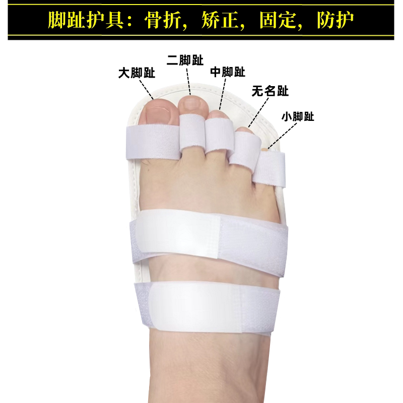 小脚趾骨折护具打石膏趾骨跖骨裂夹板大小中脚趾夹板保护套固定器