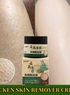 Herbal Repair Chicken Skin Cream Moisturize Remove Thick