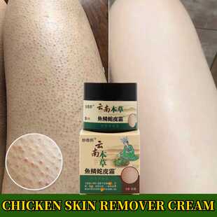 Herbal Repair Chicken Skin Cream Moisturize Remove Thick